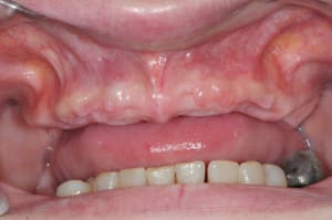 Dsc 1854 d96nep - Eugenol