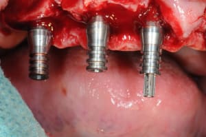 Dsc 1872 nw5s9a - Eugenol