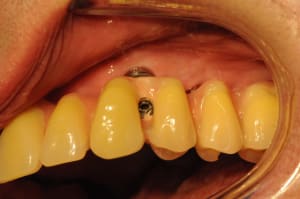 Dsc 1888 rx8sc6 - Eugenol