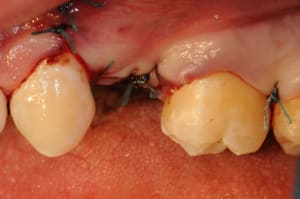 Dsc 2147 wolx9z - Eugenol