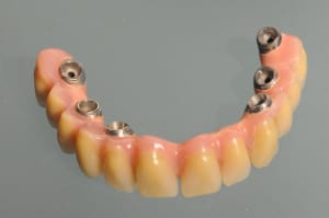 Dsc 2526 mhkuxw - Eugenol