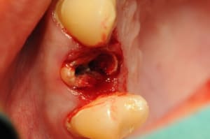 Dsc 2553 awmh32 - Eugenol