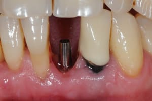 Dsc 3333 oo5v6n - Eugenol
