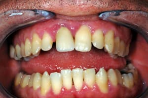 Dsc 3487 cecz0v - Eugenol