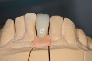 Dsc 3539 kldgfy - Eugenol