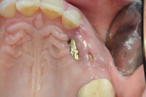 Dsc 3570 rjakcc - Eugenol