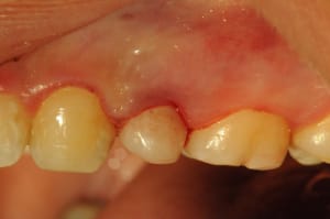 Dsc 4137 tebfuv - Eugenol
