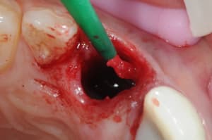 Dsc 4262 frqnjt - Eugenol