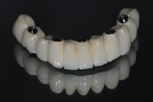 Dsc 4361 fgvq00 - Eugenol