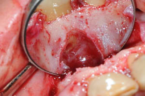 Dsc 5003 gjuyxf - Eugenol