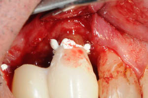 Dsc 5089 hlrhkc - Eugenol
