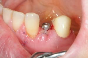 Dsc 5166 fetsbg - Eugenol