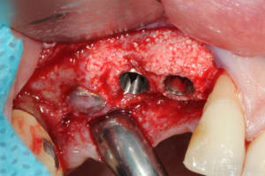 Dsc 5218 kn6nwf - Eugenol