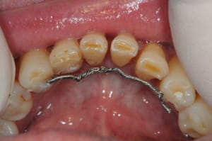 Dsc 5221 talcal - Eugenol