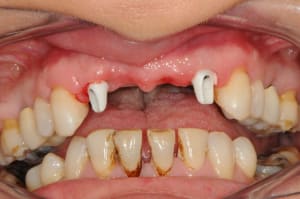 Dsc 5344 ql86yj - Eugenol