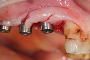 Dsc 5543 fznoez - Eugenol
