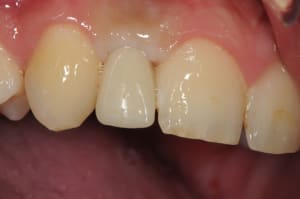 Dsc 5692 vnaw4w - Eugenol