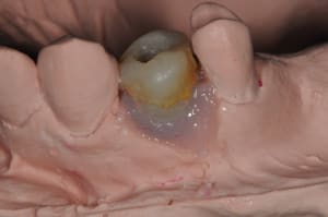 Dsc 5857 sv7ry5 - Eugenol
