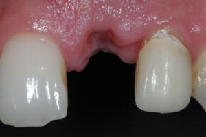 Dsc 5950 wakvmm - Eugenol