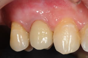 Dsc 6159 dqewaf - Eugenol