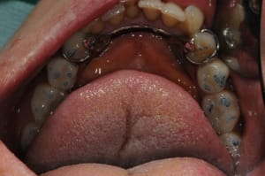 Dsc 6377 ifxwsl - Eugenol