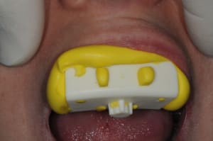Dsc 6453 l2pwdw - Eugenol