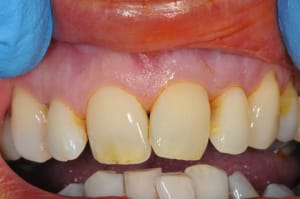 Dsc 6464 a8y81b - Eugenol