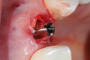 Dsc 6492 tt0atn - Eugenol