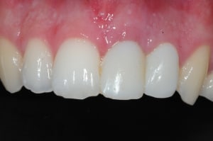 Dsc 6514 dx32uf - Eugenol