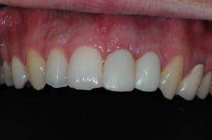 Dsc 6781 ccv1bz - Eugenol