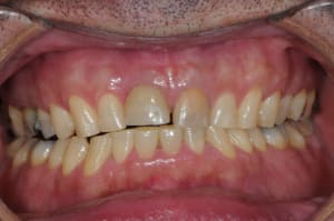 Dsc 6986 bhfoh3 - Eugenol