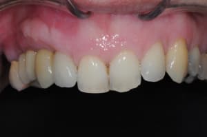 Dsc 7103 ieatvk - Eugenol