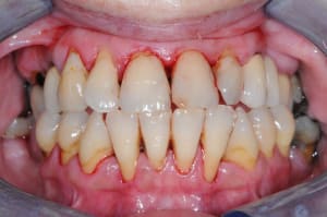 Dsc 7827 hzwxrt - Eugenol