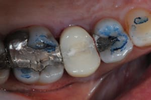 Dsc 7945 rt7lkw - Eugenol