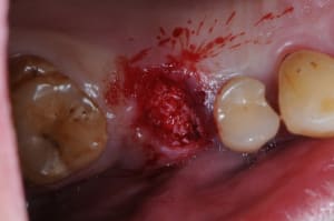 Dsc 8861 ivwiaw - Eugenol