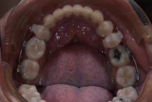 Dsc 9424 mpdam8 - Eugenol