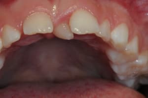 Dsc 9478 mcvpoy - Eugenol