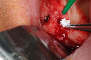 Dsc 9698 vslj7g - Eugenol