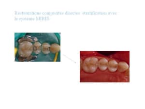 Diapositive1 zxpgqa - Eugenol