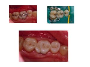 Diapositive2 ghpzq2 - Eugenol