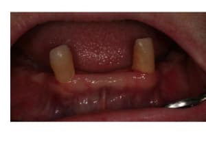 Diapositive2 uqbzk1 - Eugenol