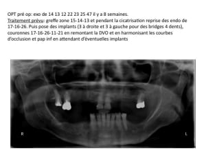 Diapositive3 culbrr - Eugenol