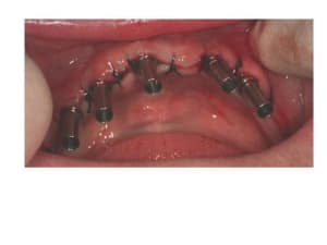 Diapositive7 ldbola - Eugenol