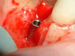 Dscf0031 legzcd - Eugenol