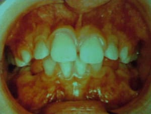 Dscf1710 rvzsvh - Eugenol
