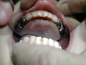 Dscn1843 nj4oly - Eugenol