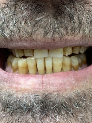 E0f295f8 9c57 40c3 adda 2743fbc1bfda klcmkx - Eugenol