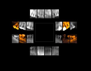 F1 bh1hff - Eugenol