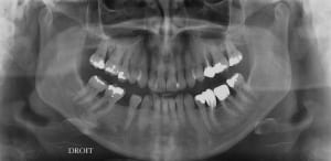 Fa elis05.04 - Eugenol