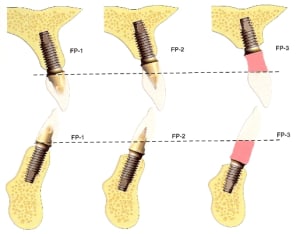 Fp mh2zex - Eugenol